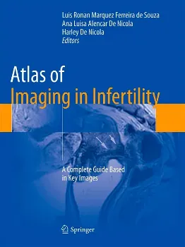 Imagem de Atlas of Imaging in Infertility: A Complete Guide Based in Key Images