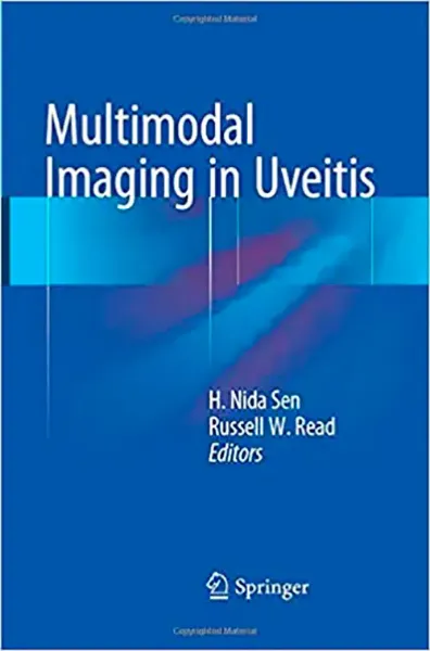 Imagem de Multimodal Imaging in Uveitis