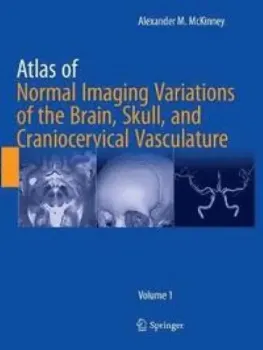 Picture of Book Atlas of Normal Imaging Variations of the Brain, Skull, and Craniocervical Vasculature