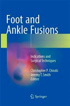 Imagem de Foot and Ankle Fusions: Indications and Surgical Techniques