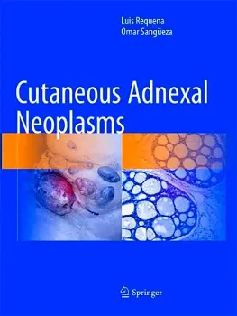 Picture of Book Cutaneous Adnexal Neoplasms