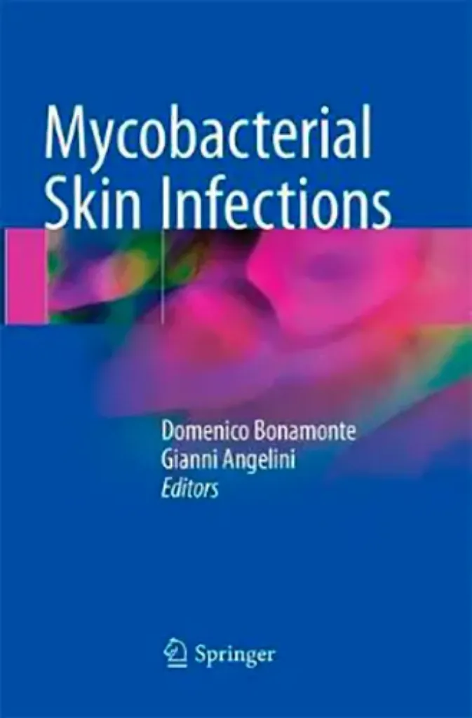 Imagem de Mycobacterial Skin Infections