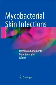 Imagem de Mycobacterial Skin Infections