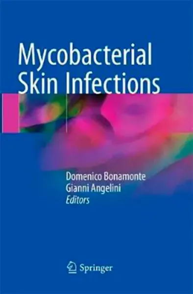 Imagem de Mycobacterial Skin Infections
