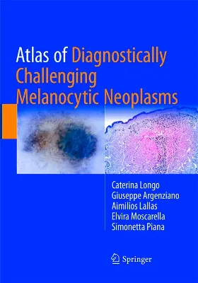 Imagem de Atlas of Diagnostically Challenging Melanocytic Neoplasms