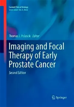 Imagem de Imaging and Focal Therapy of Early Prostate Cancer