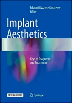 Imagem de Implant Aesthetics: Keys to Diagnosis and Treatmen