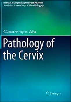 Imagem de Pathology of the Cervix