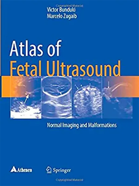 Imagem de Atlas of Fetal Ultrasound: Normal Imaging and Malformations