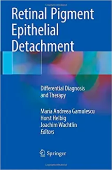 Imagem de Retinal Pigment Epithelial Detachment: Differential Diagnosis and Therapy
