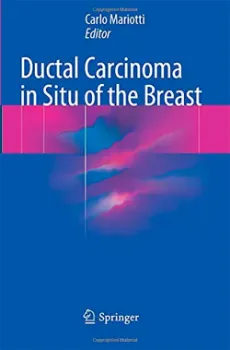 Imagem de Ductal Carcinoma in Situ of the Breast