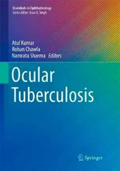 Imagem de Ocular Tuberculosis