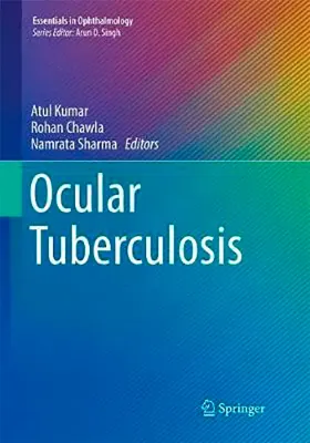 Imagem de Ocular Tuberculosis