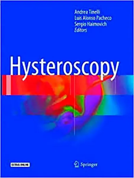 Imagem de Hysteroscopy