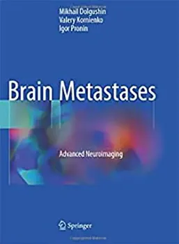 Picture of Book Brain Metastases: Advanced Neuroimaging