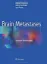Picture of Book Brain Metastases: Advanced Neuroimaging