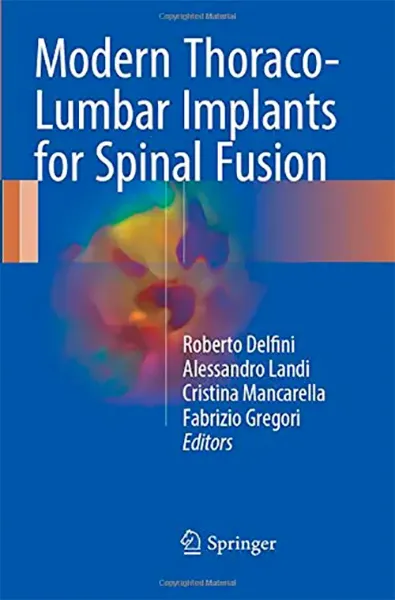 Imagem de Modern Thoraco-Lumbar Implants for Spinal Fusion
