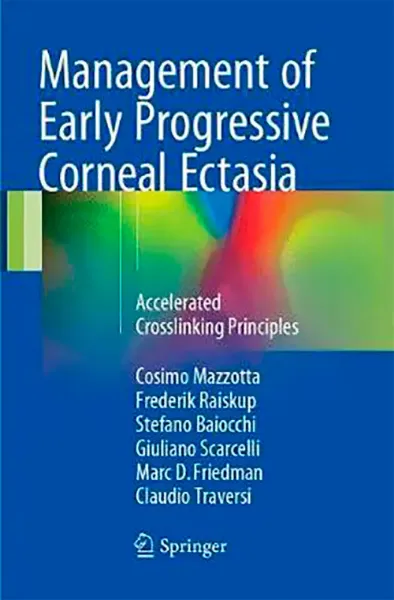 Imagem de Management of Early Progressive Corneal Ectasia: Accelerated Crosslinking Principles