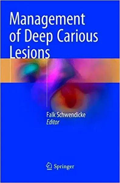 Imagem de Management of Deep Carious Lesions