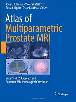 Imagem de Atlas of Multiparametric Prostate MRI: With PI-RADS Approach and Anatomic-MRI-Pathological Correlation