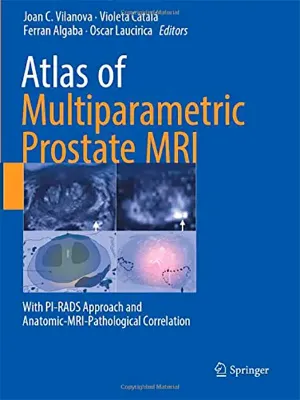 Imagem de Atlas of Multiparametric Prostate MRI: With PI-RADS Approach and Anatomic-MRI-Pathological Correlation