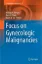 Imagem de Focus on Gynecologic Malignancies
