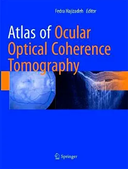 Imagem de Atlas of Ocular Optical Coherence Tomography