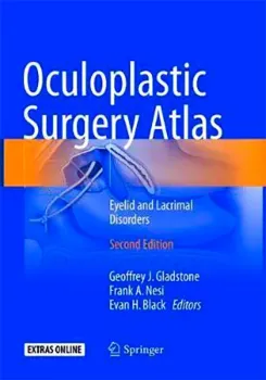 Imagem de Oculoplastic Surgery Atlas: Eyelid and Lacrimal Disorders
