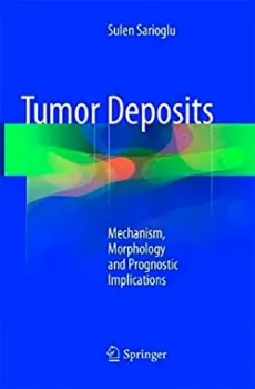 Imagem de Tumor Deposits: Mechanism, Morphology and Prognostic Implications