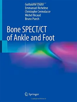 Picture of Book Bone SPECT/CT of Ankle and Foot