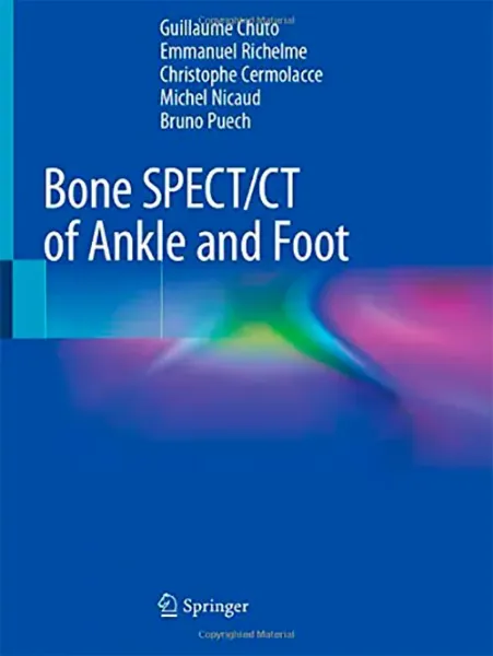 Imagem de Bone SPECT/CT of Ankle and Foot