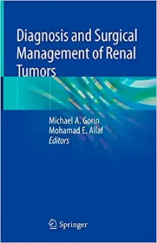 Imagem de Diagnosis and Surgical Management of Renal Tumors