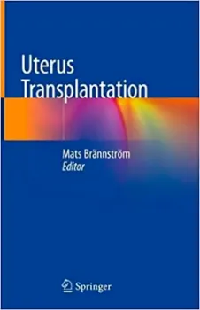 Picture of Book Uterus Transplantation