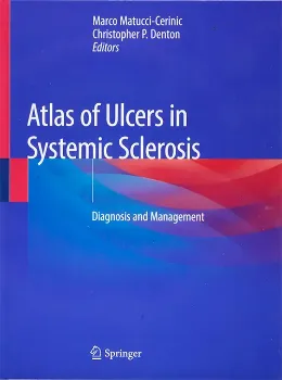 Imagem de Atlas of Ulcers in Systemic Sclerosis: Diagnosis and Management