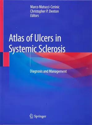Imagem de Atlas of Ulcers in Systemic Sclerosis: Diagnosis and Management