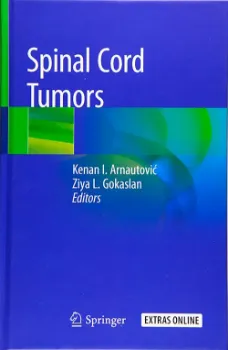 Picture of Book Spinal Cord Tumors