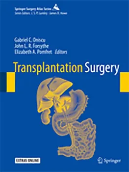 Picture of Book Transplantation Surgery