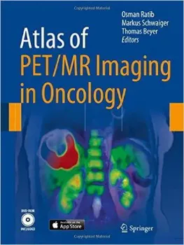 Imagem de Atlas of PET/MR Imaging in Oncology