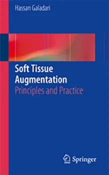 Imagem de Soft Tissue Augmentation: Principles and Practice
