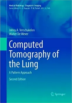 Picture of Book Computed Tomography of the Lung: A Pattern Approach
