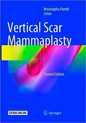Picture of Book Vertical Scar Mammaplasty