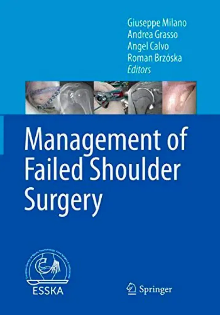 Imagem de Management of Failed Shoulder Surgery