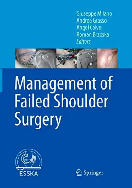 Imagem de Management of Failed Shoulder Surgery
