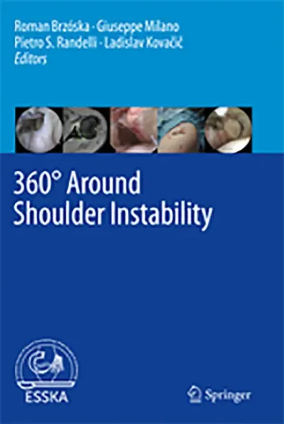Imagem de 360° Around Shoulder Instability