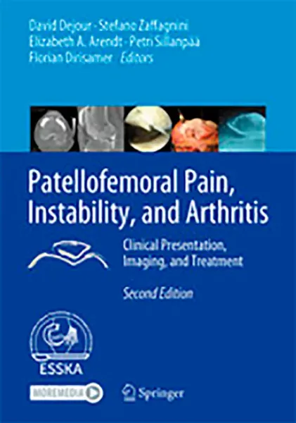 Imagem de Patellofemoral Pain, Instability, and Arthritis: Clinical Presentation, Imaging and Treatment