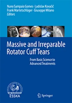 Imagem de Massive and Irreparable Rotator Cuff Tears: From Basic Science to Advanced Treatments