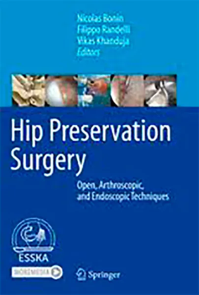 Imagem de Hip Preservation Surgery: Open, Arthroscopic and Endoscopic Techniques