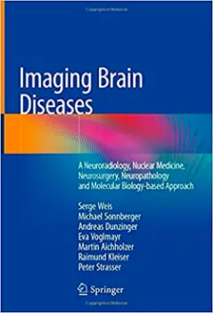 Imagem de Imaging Brain Diseases: A Neuroradiology, Nuclear Medicine, Neurosurgery, Neuropathology and Molecular Biology-based Approach