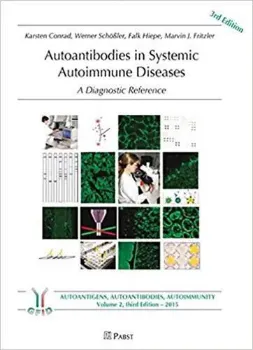 Imagem de Autoantibodies in Systemic Autoimmune Diseases