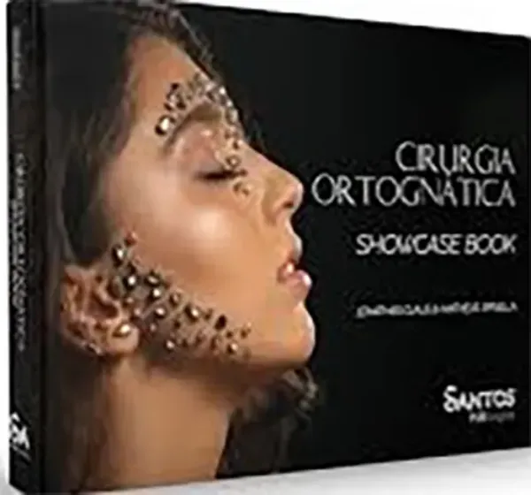 Imagem de Cirurgia Ortognática - Showcase Book